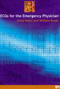 ECGs for the Emergency Physician