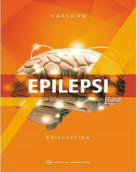 Epilepsi